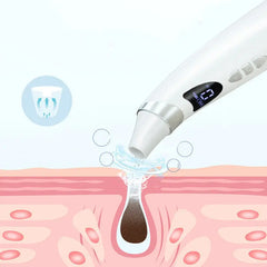 Electric Visual Blackhead Suction Instrument Household Cleansing Pore Cleaner For Skin Equipment Skin Care Tool Mytrendss