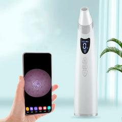 Electric Visual Blackhead Suction Instrument Household Cleansing Pore Cleaner For Skin Equipment Skin Care Tool Mytrendss